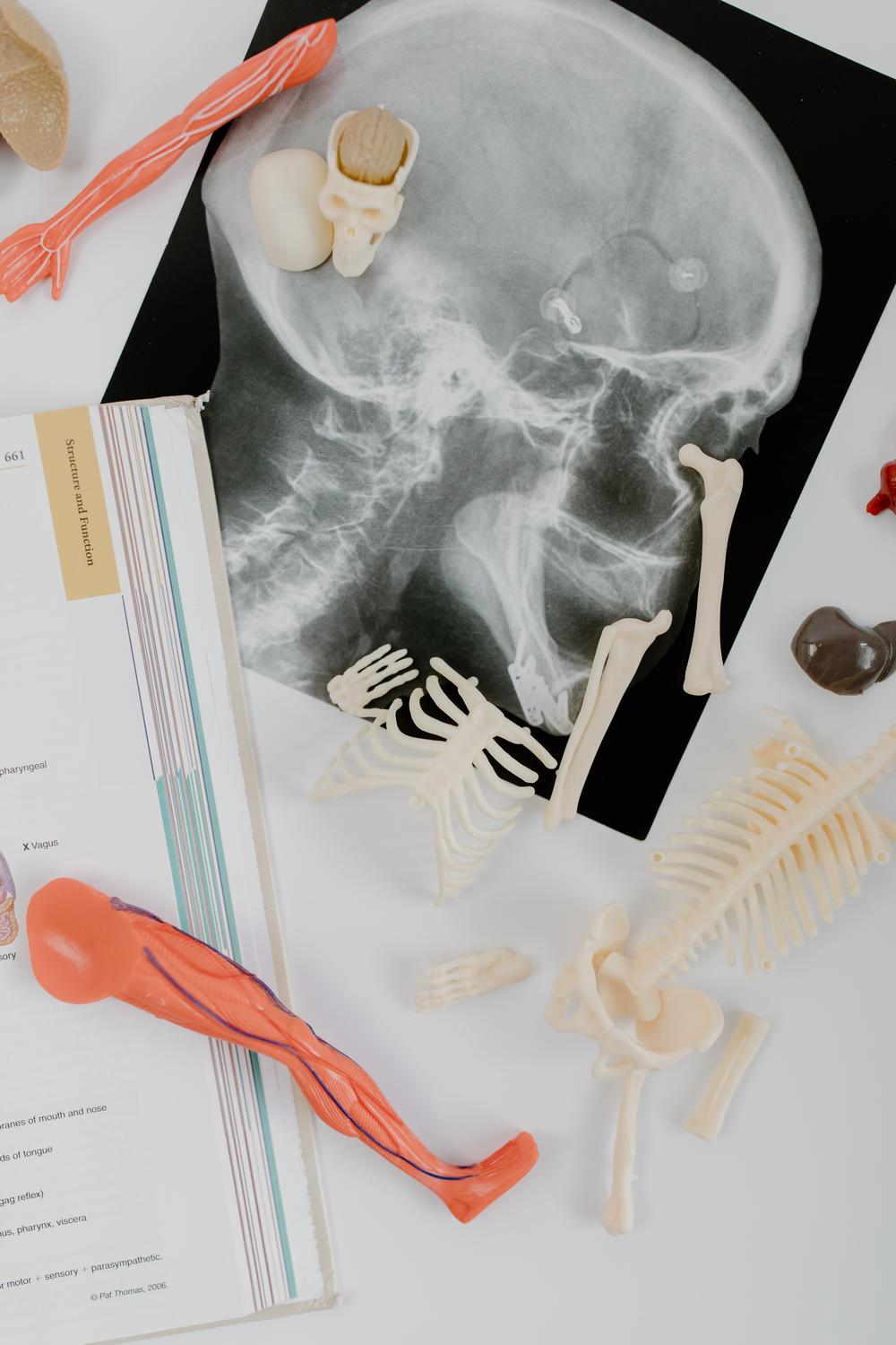 X-ray scan of scull on table with figurines of skeleton pieces and an open book.